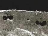 10 - Vecchi concettacoli immersi nello spessore del tallo